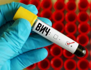 ВИЧ - инфекция