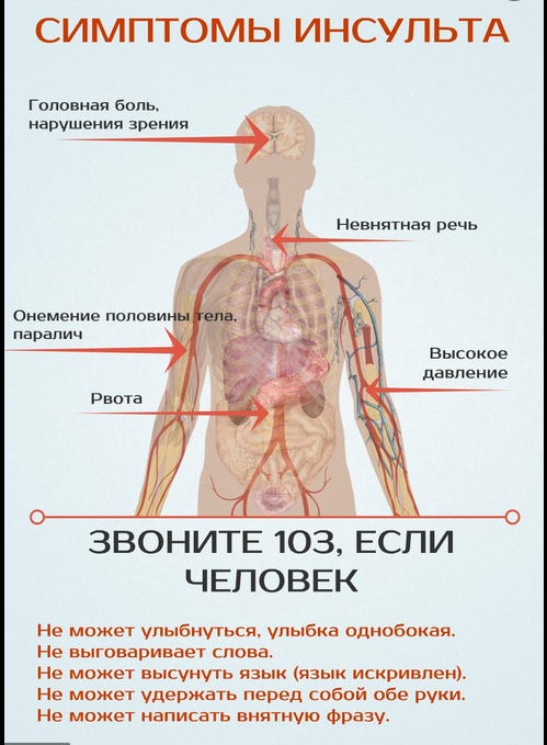 «СОГАЗ-Мед» о том, как распознать инсульт и оказать первую помощь